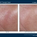 SkinBetter Before and After