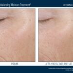 SkinBetter Before and After