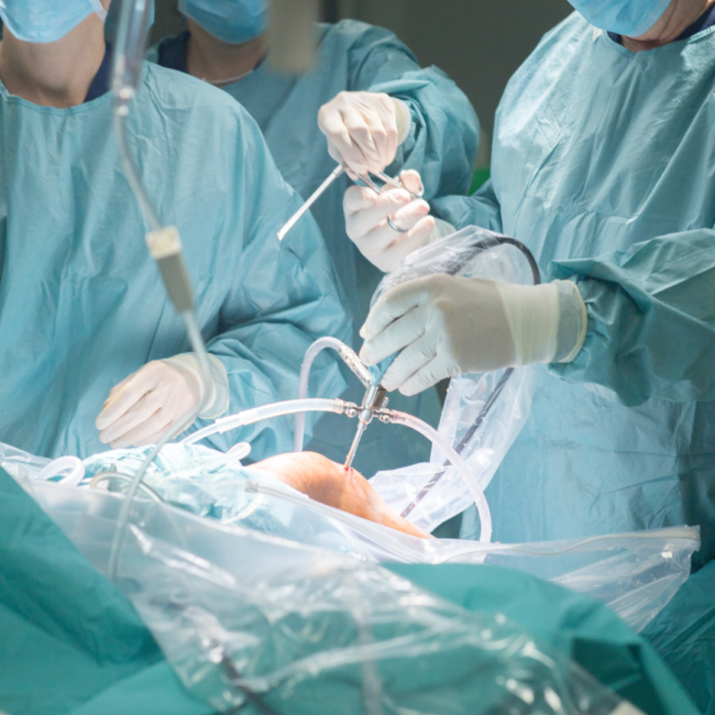 Do you still have knee pain after a knee replacement?