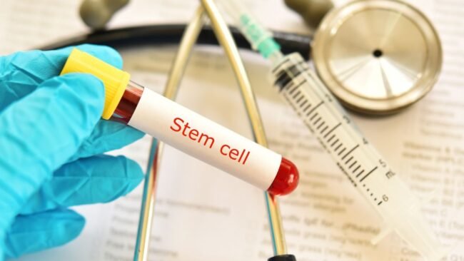Bone Marrow Stem Cell Therapy