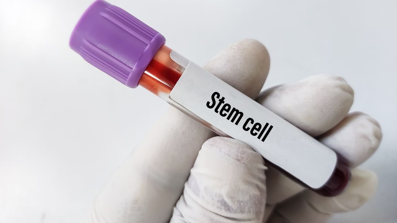 Blog 28 Are You a Candidate for Stem Cell Therapy in Scottsdale