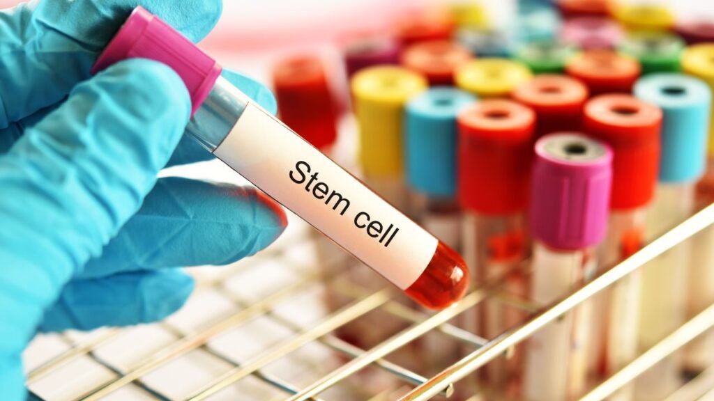 Stem Cell Therapy