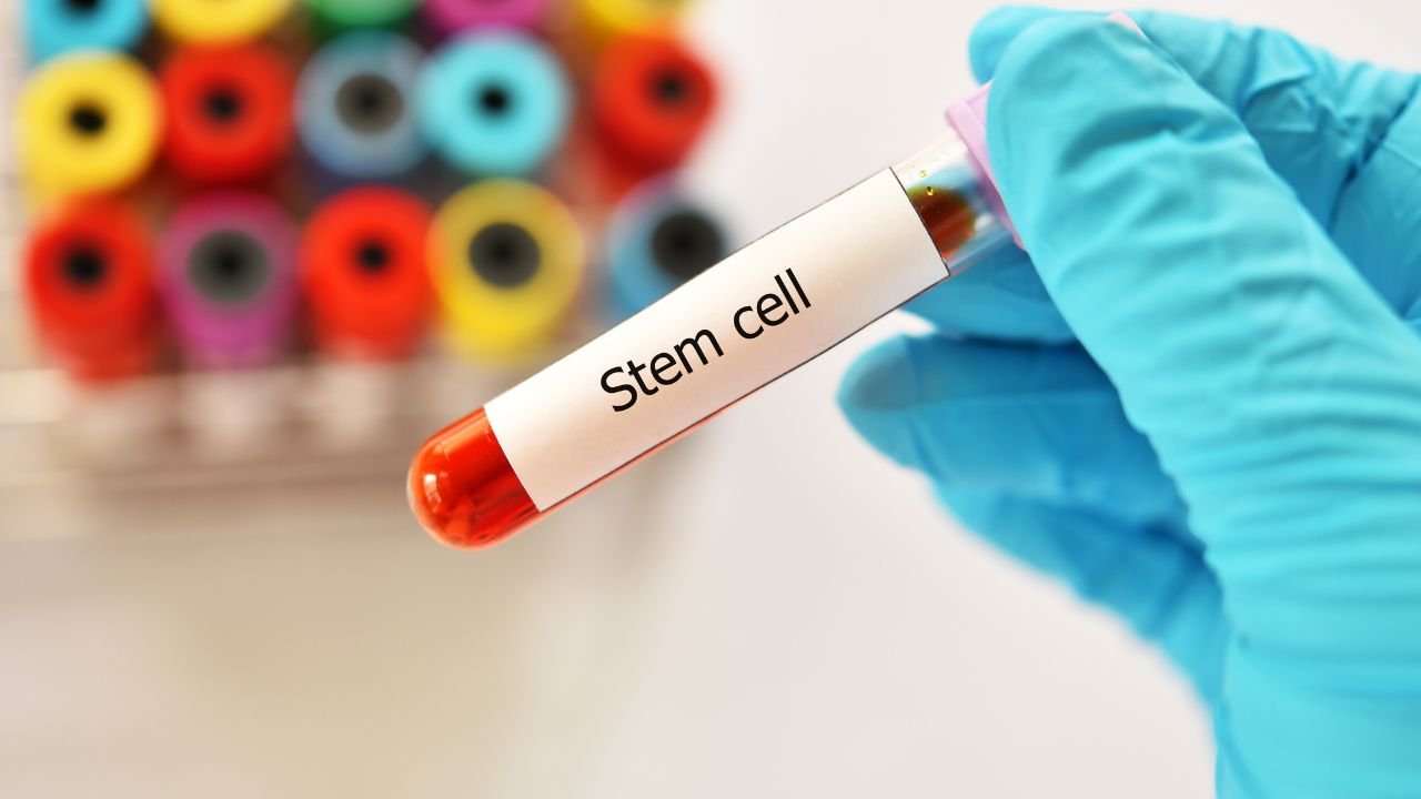 Blog 22 Stem Cell Therapy for Neuropathy