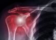 Regenokine for shoulder injuries