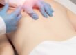pain treatment